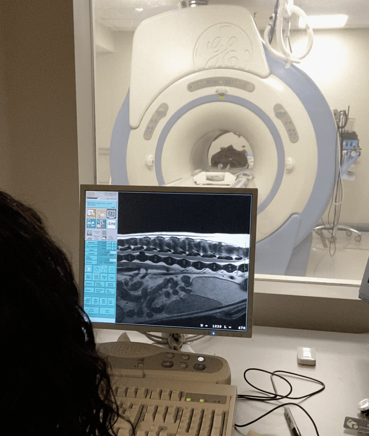 MRI at SEVN