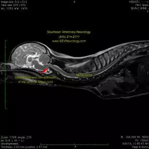 Luna Berger Mri Pre Op