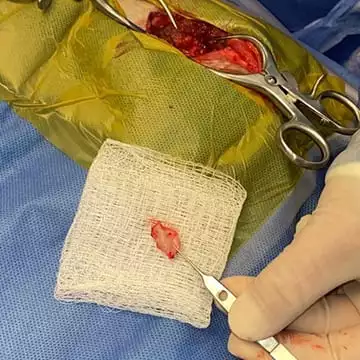 Case Study Milo Bone Fragment