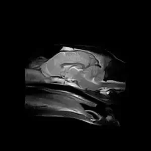 Low Field Mri Low Field Mri