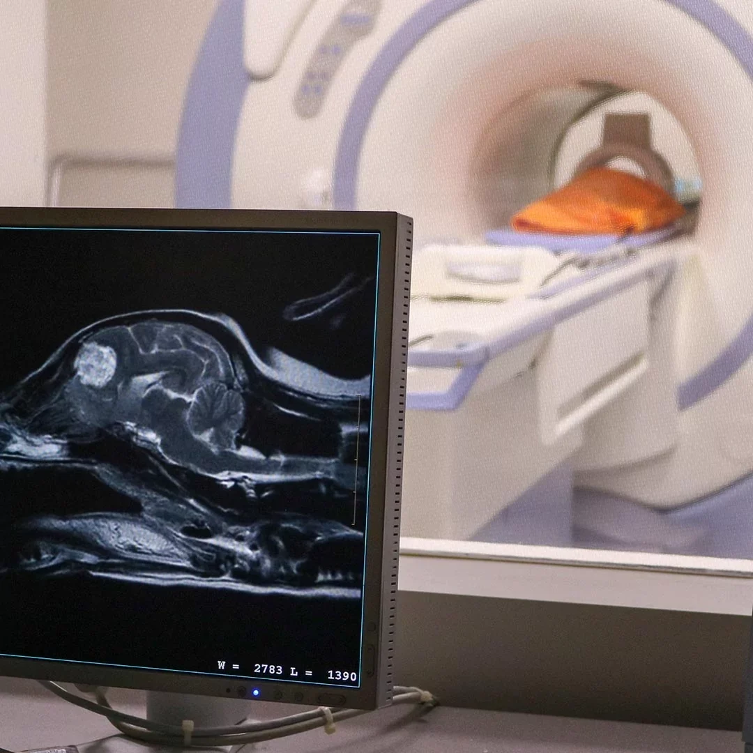 Mri Control Room Miami Brain Tumor Scan MRI Control Room Miami Brain Tumor Scan
