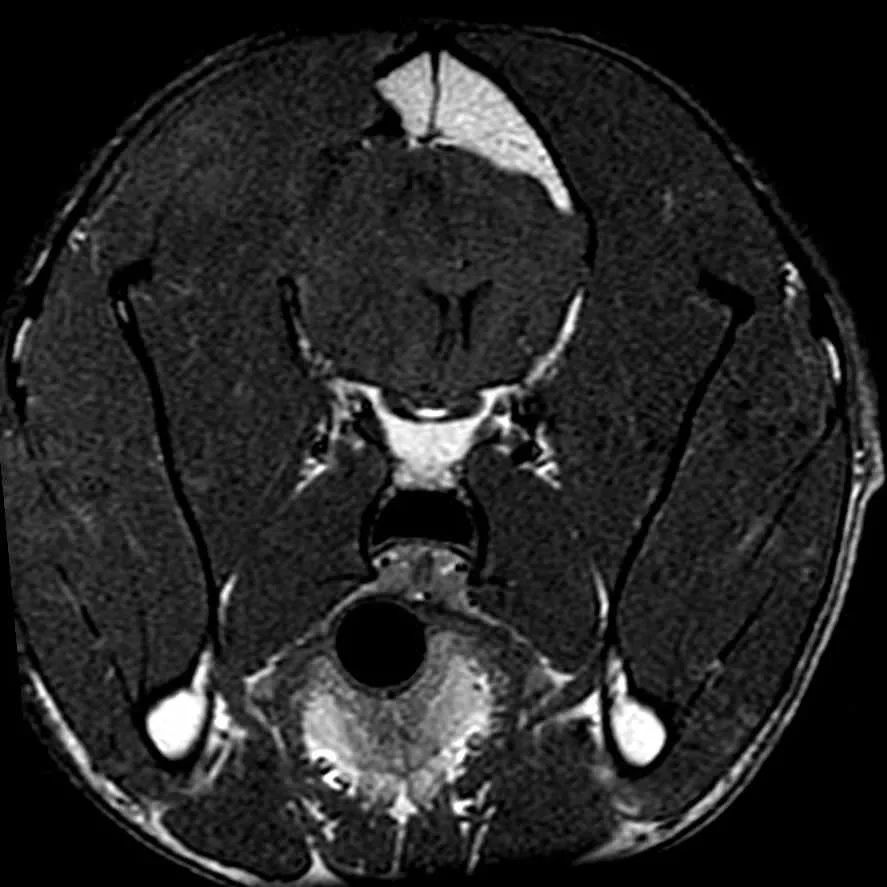Postoperative Mri Dog Brain Tumor