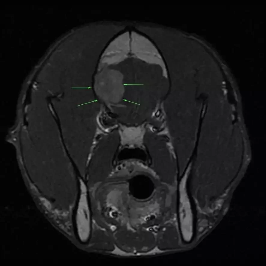Preoperative Mri Dog Brain Tumor